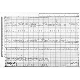 ANALYSIS OF FORESHORE TIDE GUAGE CHARTS
